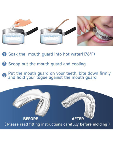 Paquete de 6 Protectores Bucales Mictaning para Bruxismo