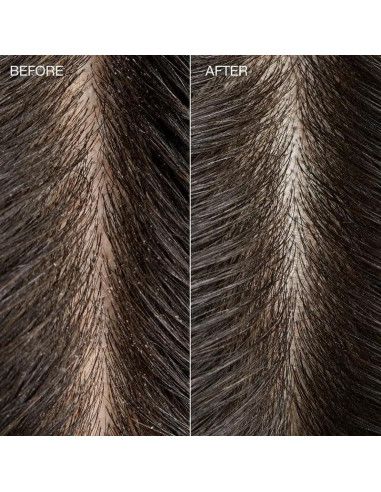 Enjuague Detox de Kombucha Árbol de Té 74 ml - Brillo y Suavidad