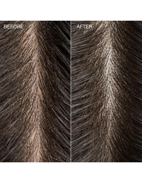 Enjuague Detox de Kombucha Árbol de Té 74 ml - Brillo y Suavidad