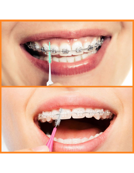 Zopeal 250 Piezas Cepillos Interdentales y Hilo Dental