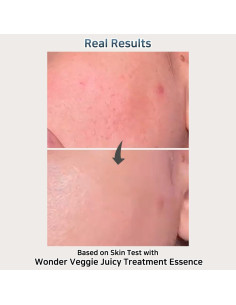 Tónico Hidratante Facial Hersteller 150 ml - Vegano, K-Beauty 2