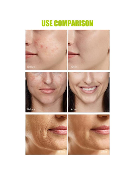 Conjunto de Cuidado de la Piel Aichun Beauty 5 Piezas Hidratante