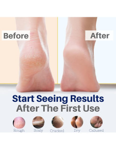 Crema para Pies Yellow Bird - Balsamo Natural 56.7g 2