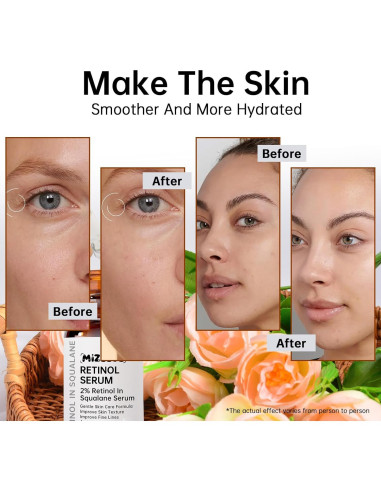 Suero de Retinol 2% MIZEEYE en Escualano 30ml Hidratante