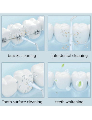 Manguera y Mango de Repuesto Waterpik WP-100 WP-300 Blanco