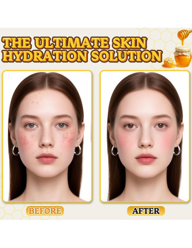 Bálsamo Hidratante Facial de Grasa de Res Yourtone 120g