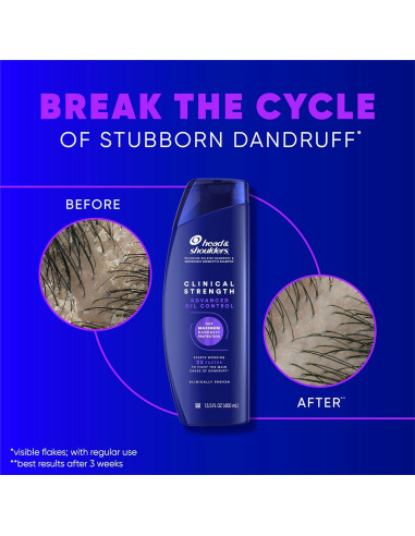 Champú Anticaspa Head & Shoulders Doble Fuerza 1L Cítrico