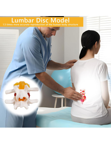 Modelo de Hernia de Disco Lumbar Breesky 1.5x Detalle