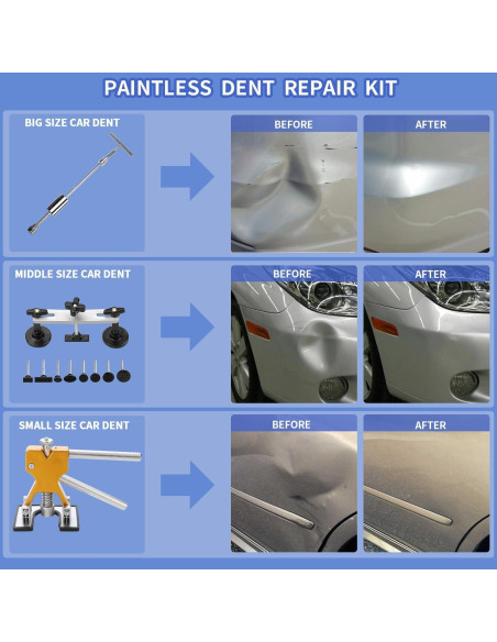 Kit de Herramientas para Reparación de Abolladuras ROADGIVE 97 Piezas