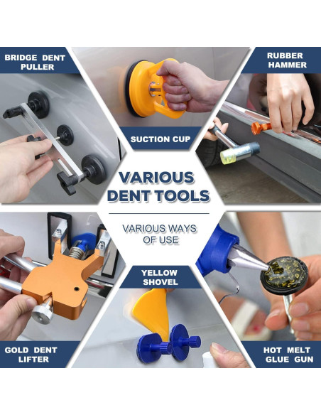 Kit de Reparación de Abolladuras ROADGIVE 75PCS Ergonómico