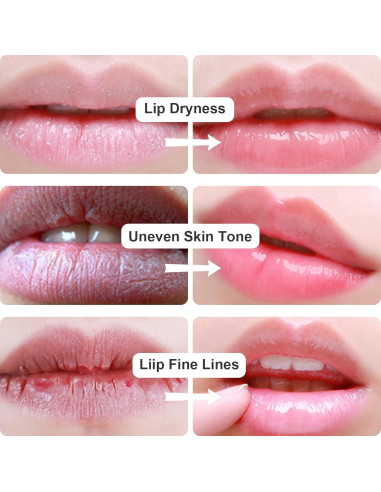 Mascarilla de Colágeno para Labios Permotary 30 Pcs Hidratante