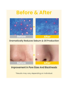 Limpiador de Aceite Elvira para Piel Sensible 180ml 2