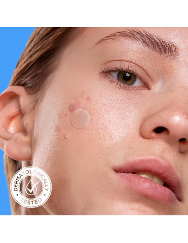 Parches para Acné AVARELLE Hydrocolloid 24 Unidades
