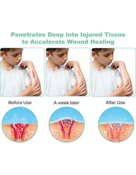 Dispositivo de Terapia de Luz Roja Aswaysun 5 LEDs Alivio Dolor Dispositivo de Terapia de Luz Roja Aswaysun 5 LEDs Alivio Dolor