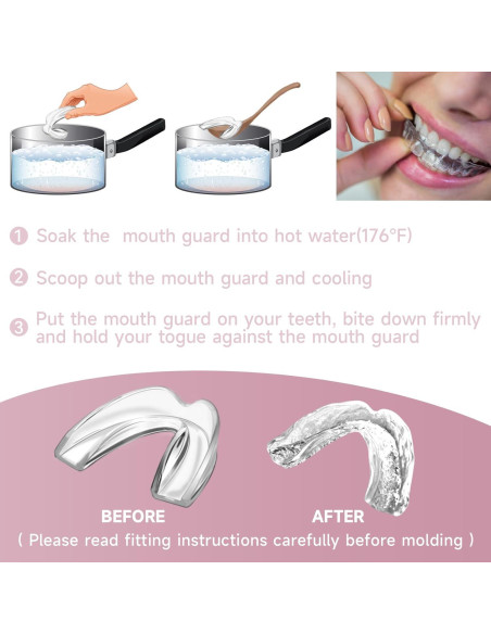 Paquete de 4 Protectores Bucales Medianos Natrlteeth Rosados