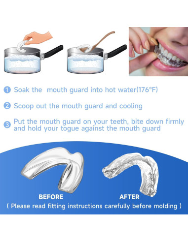 Paquete de 4 Protectores Bucales Azules Natrlteeth Medianos