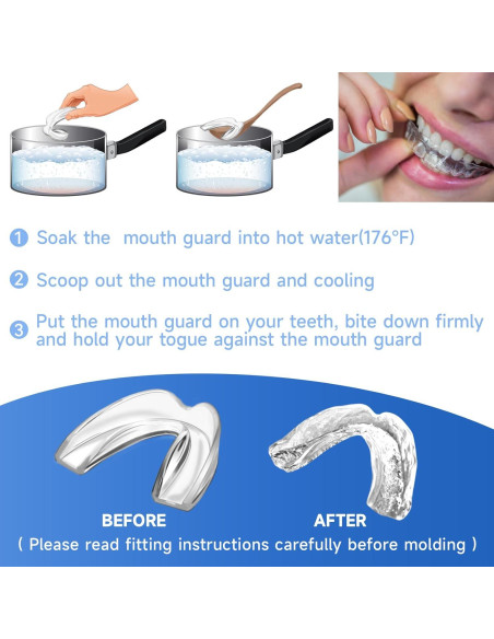 Paquete de 4 Protectores Bucales Azules Natrlteeth Medianos