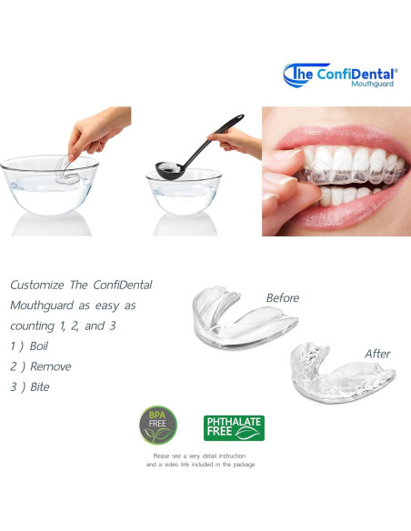 Paquete de 3 Protectores Bucales Moldables ConfiDental