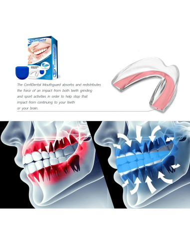 Paquete de 3 Protectores Bucales Moldables ConfiDental