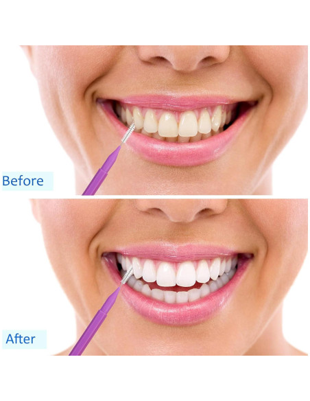 100 Piezas Cepillos Interdentales Patelai - Higiene Oral Completa