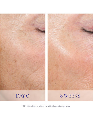 Sistema de Pelado Activo iS CLINICAL 2 Pasos Exfoliación