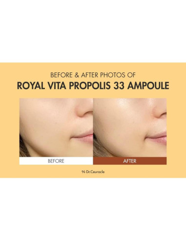 Suero Vitamínico Dr.Ceuracle Real Vita Propolis 30 ml