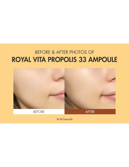 Suero Vitamínico Dr.Ceuracle Real Vita Propolis 30 ml