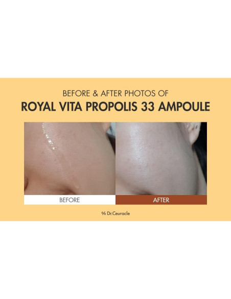 Suero Vitamínico Dr.Ceuracle Real Vita Propolis 30 ml