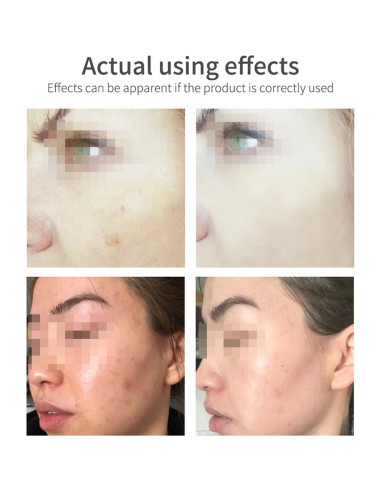 Espuma Limpiadora Facial DISAAR Belleza 100ml Vitamina E