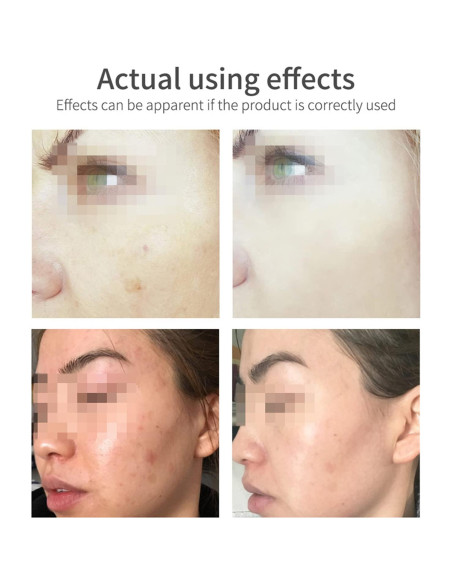 Espuma Limpiadora Facial DISAAR Belleza 100ml Vitamina E