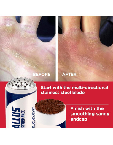 Callus Score - Removedor de Callos para Atletas 12.7cm