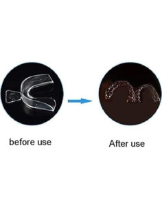 4 Protectores Nocturnos de Silicona Gryshanyun para Bruxismo 2