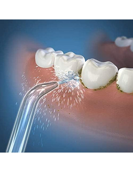 Consejos de chorro clásico Waterpik VWONST - Paquete de 9