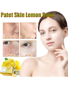 Jabón Patet Skin de Limón 108g - Cuidado de Piel Hiperpigmentación 2