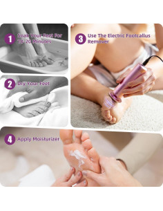 Removedor de Callos Eléctrico YPWRENH 3101-B 3 Velocidades Rosa 2