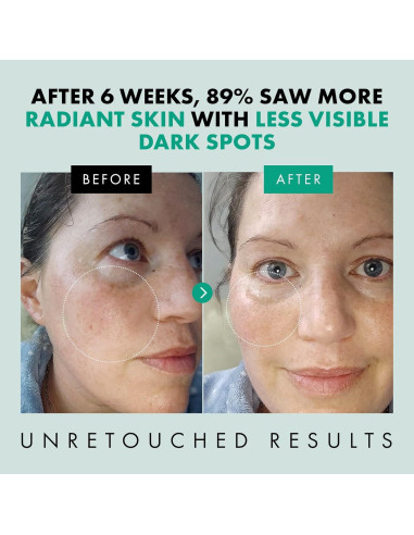 Suero de Niacinamida Eclat Skincare 30 ml - Iluminador y Minimizador de Poros