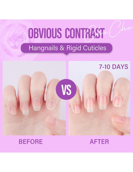 Aceite Orgánico para Cutículas CHUCHU 15ml - Jojoba y Vitaminas