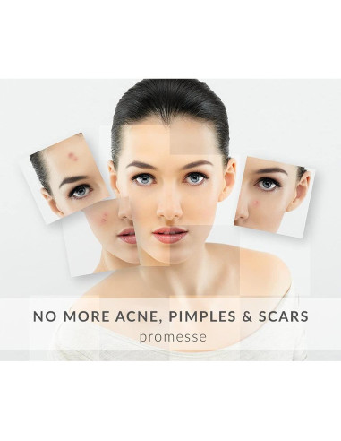 Limpiador Facial Promesse 118ml - Control de Acné y Anti-Envejecimiento