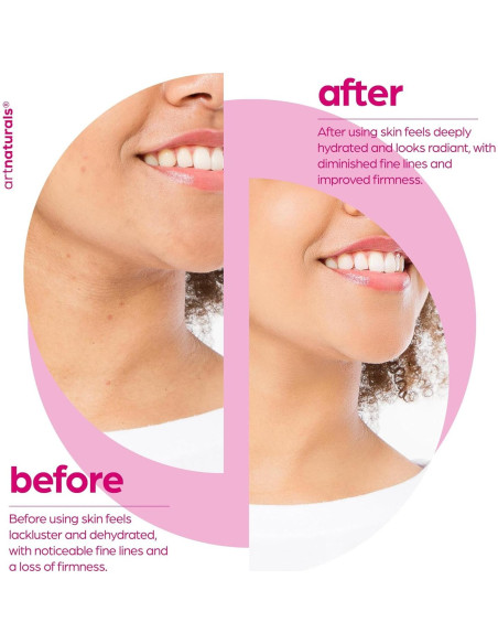 Suero Facial Antienvejecimiento Artnaturals 28.35 g - Colágeno