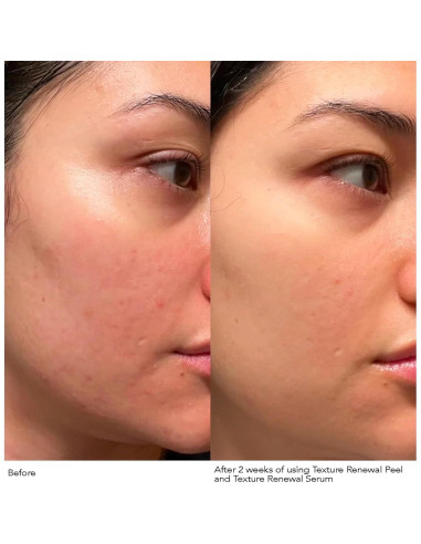 Suero Antienvejecimiento Dr. Dennis Gross 28.35 g - Textura Suave