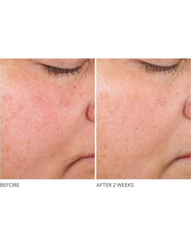 Suero Antienvejecimiento Dr. Dennis Gross 28.35 g - Textura Suave