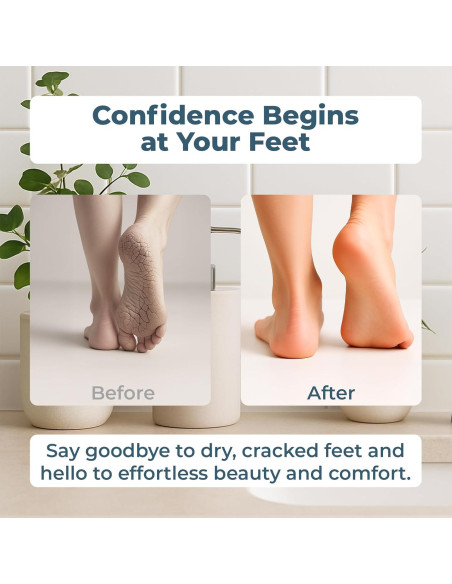 Removedor de Callos Eléctrico VISOFO 13 en 1, Cuidado de Pies