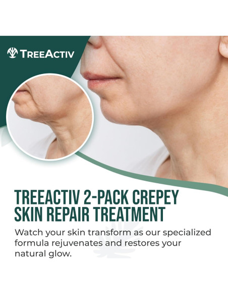 TreeActiv Crema Reafirmante para Piel Crepey - 2 Unidades - Ácido Hialurónico