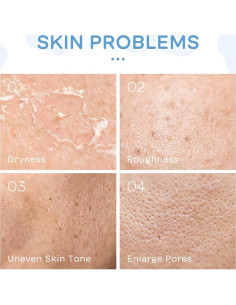 Kit de Cuidado Facial ARCHIDATE con Leche - 8 Piezas Hidratantes 2