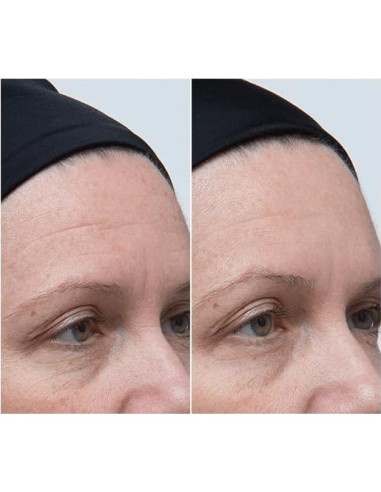 Aceite de Moringa Haitiano KREYL ESSENCE 14.79 ml