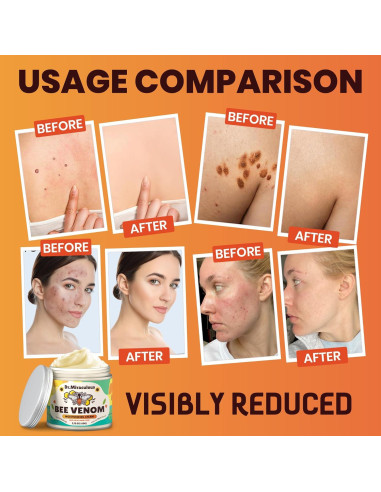 Crema Antienvejecimiento Dr. Miraculous con Veneno de Abeja 62.8 ml