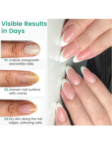 Bolígrafo Empujador de Cutículas Rosiour 3 en 1 Cerámica 12.7cm