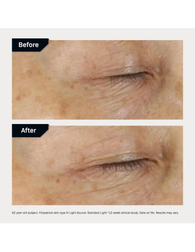 Crema para los Ojos Revision Skincare DEJ 7.09g Hidratante