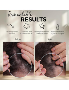 Cepillo Masajeador de Cuero Cabelludo Fiora Naturals - Exfoliador de Silicona para Caspa y Crecimiento del Cabello 2