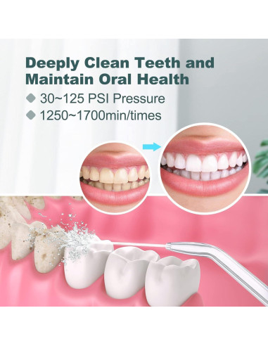 Irrigador Oral Eléctrico Homuserr 600ml con 10 Presiones y 8 Puntas